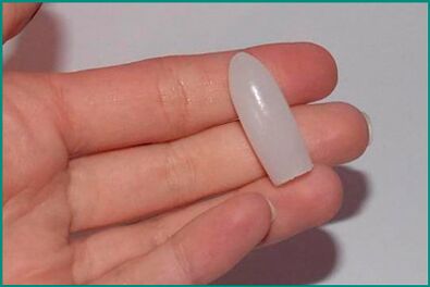 Suposiidid tsüstiidi raviks naistel ja meestel